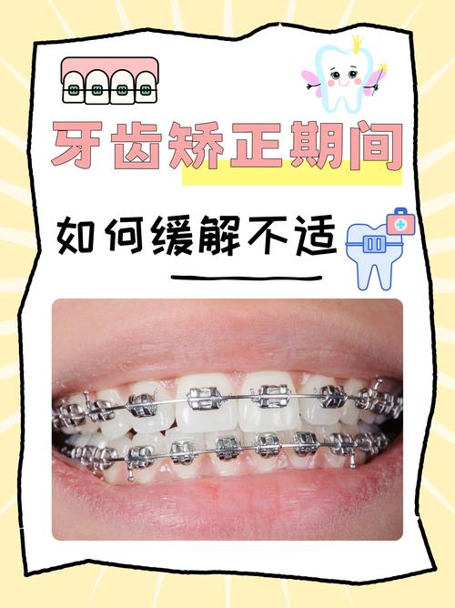 牙齿开合矫正最快方法是什么？如何才能让矫正时间最短且见效快？-图3