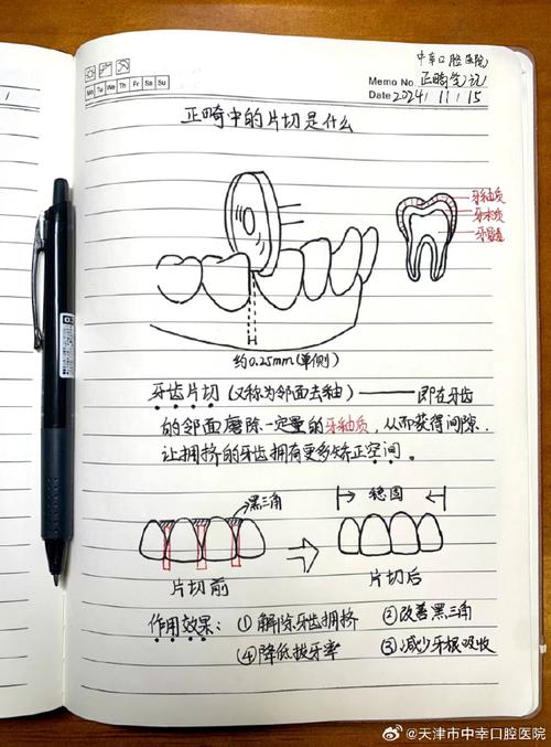 口腔正畸零基础怎么学-图2