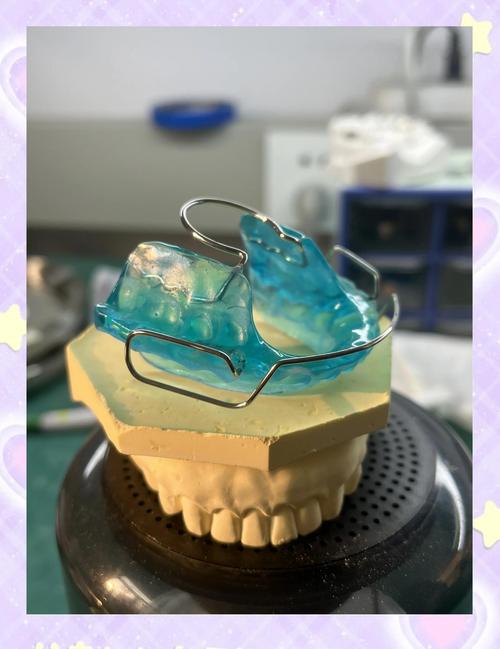 正畸头帽矫正器的适应症具体包括哪些口腔情况？-图2