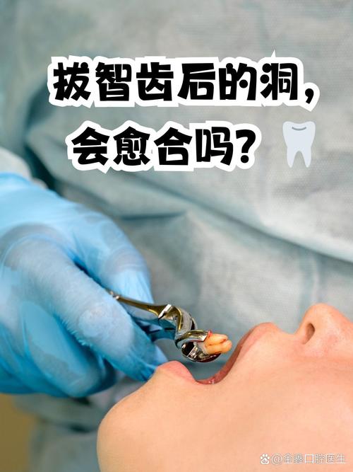 拔掉智齿后，是否都需要种牙来修复？-图1
