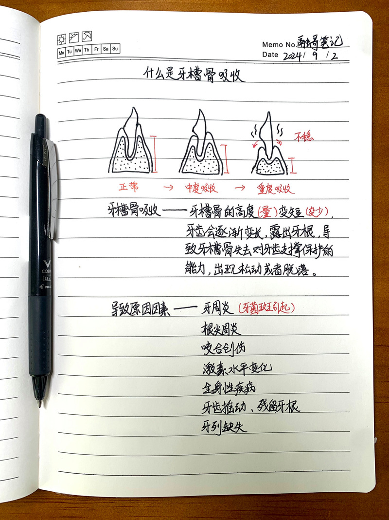 升牙槽骨有几种方法-图2 升牙槽骨有几种方法-图2