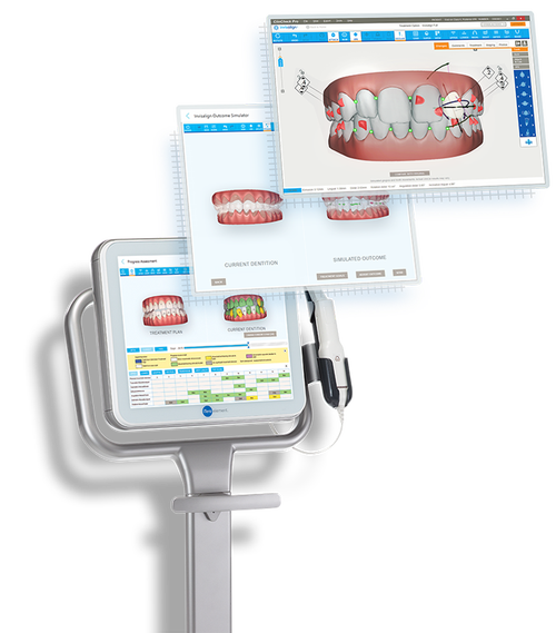 数字化正畸个性化设计如何实现精准定制?-图3 数字化正畸个性化设计如何实现精准定制?-图3
