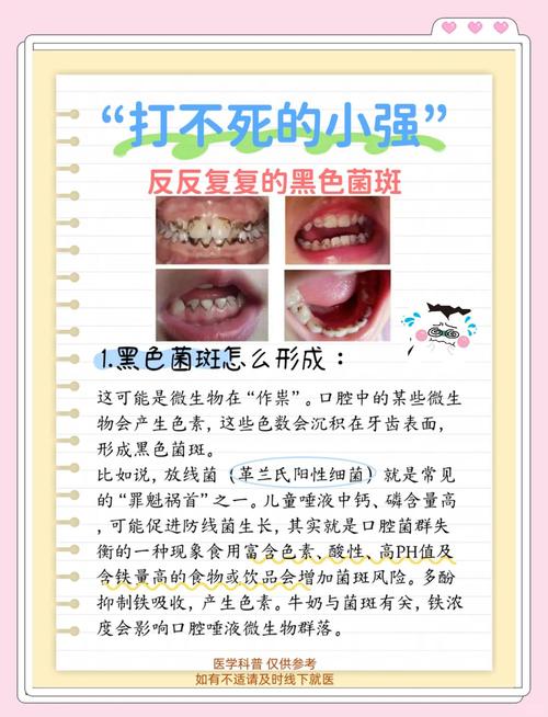 牙上长黑点解决方法-图1