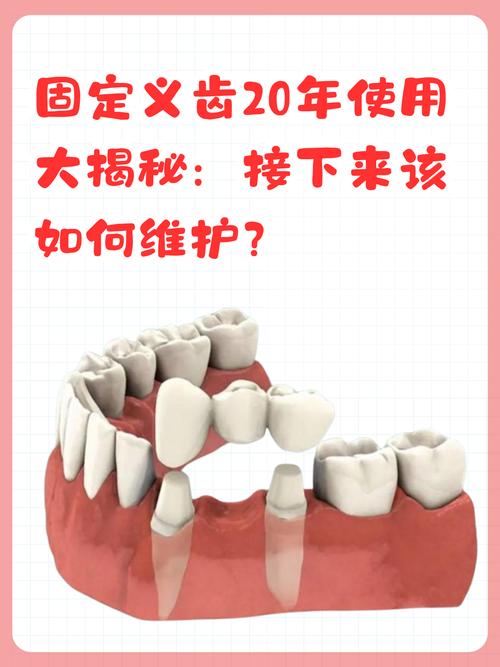缺失两颗牙后，常见的修复方法有哪些呢？如何选择适合自己的？-图1