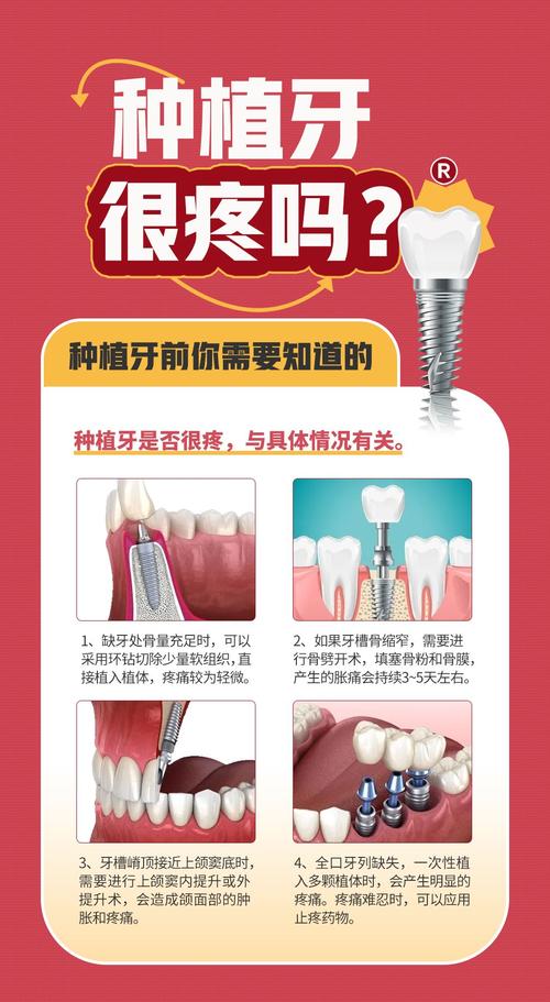 补牙和种牙 谁更痛-图1
