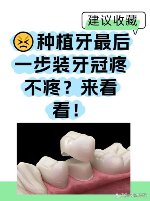 种牙后牙冠怎么戴？详细步骤有哪些？-图1