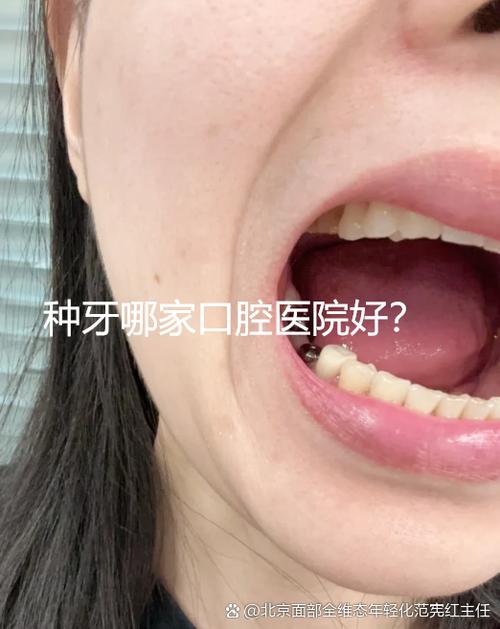 种牙能刷医保卡吗？-图1