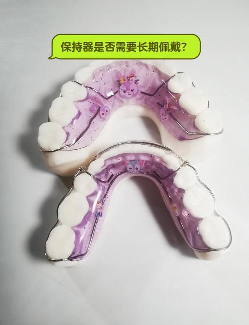 种牙后都需要戴保持器吗？-图2