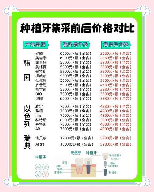 惠州惠阳种牙一颗要花多少钱？-图2