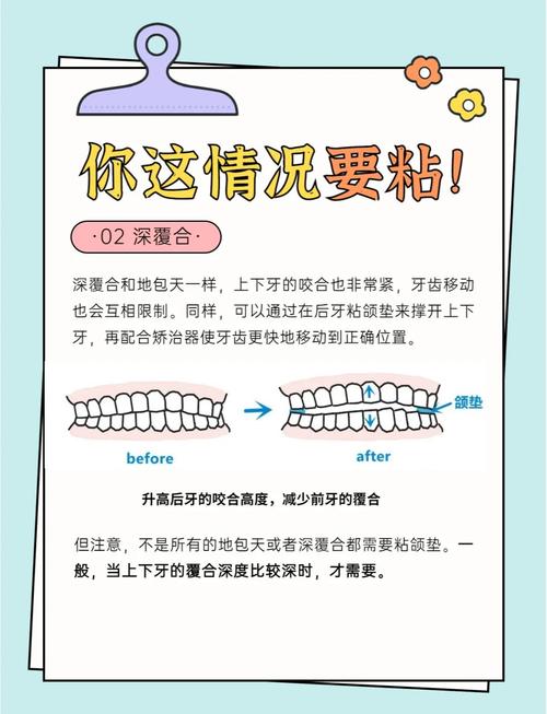 牙垫底方法有哪几种?常见类型、适用场景及选择技巧解析?-图1 牙垫底方法有哪几种?常见类型、适用场景及选择技巧解析?-图1