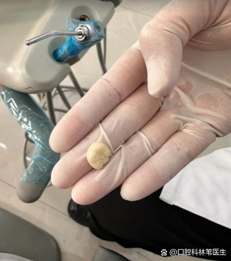 石家庄三博口腔种牙效果好不好？价格贵不贵？技术靠谱吗？-图2