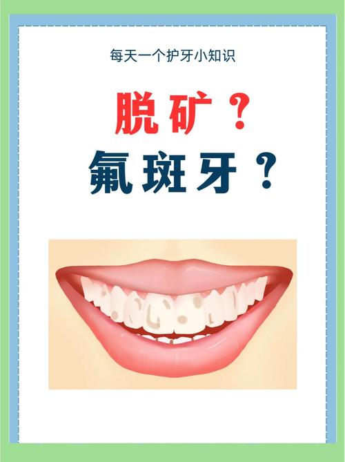 氟斑牙修复方法图解-图2