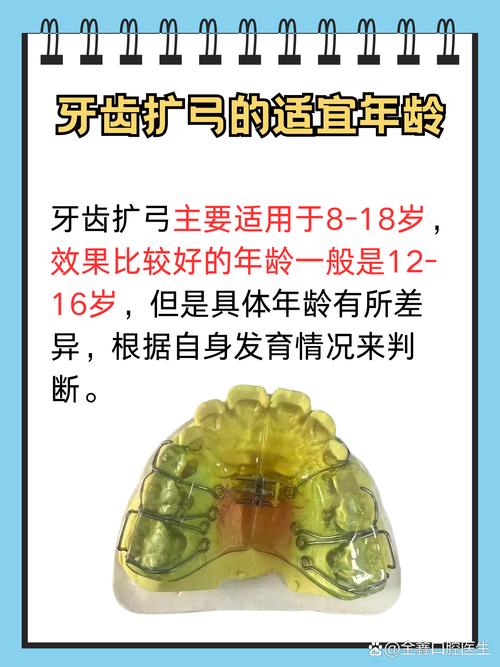 正畸弓丝外展弯的原因是什么?其设计原理与临床应用价值何在?-图2 正畸弓丝外展弯的原因是什么?其设计原理与临床应用价值何在?-图2