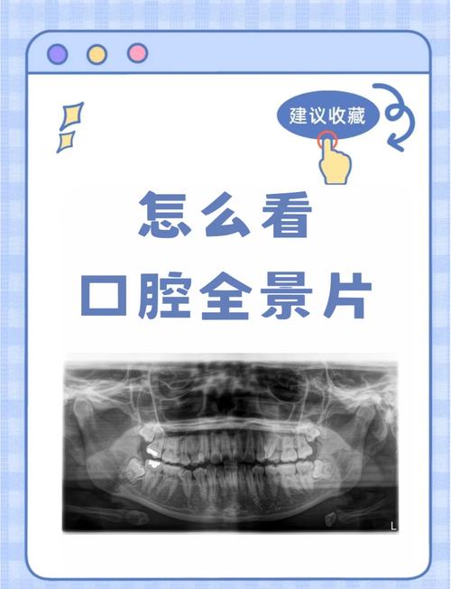 全口牙颌位记录方法有哪些？如何规范操作并确保精准记录？-图3