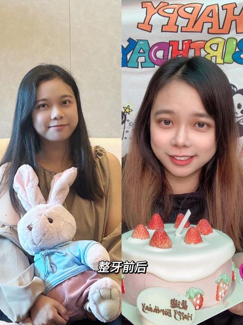 正畸正确拍照该拍哪？必拍部位与角度全解析指南-图2