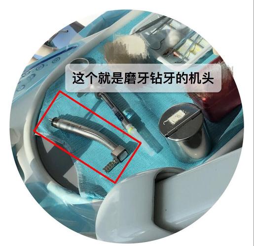 厚牙烤瓷牙制备的关键方法与操作步骤有哪些？-图1