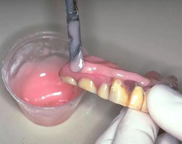 义齿垫软衬方法和图-图2