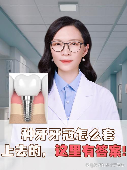 种牙完当天能上班吗-图3