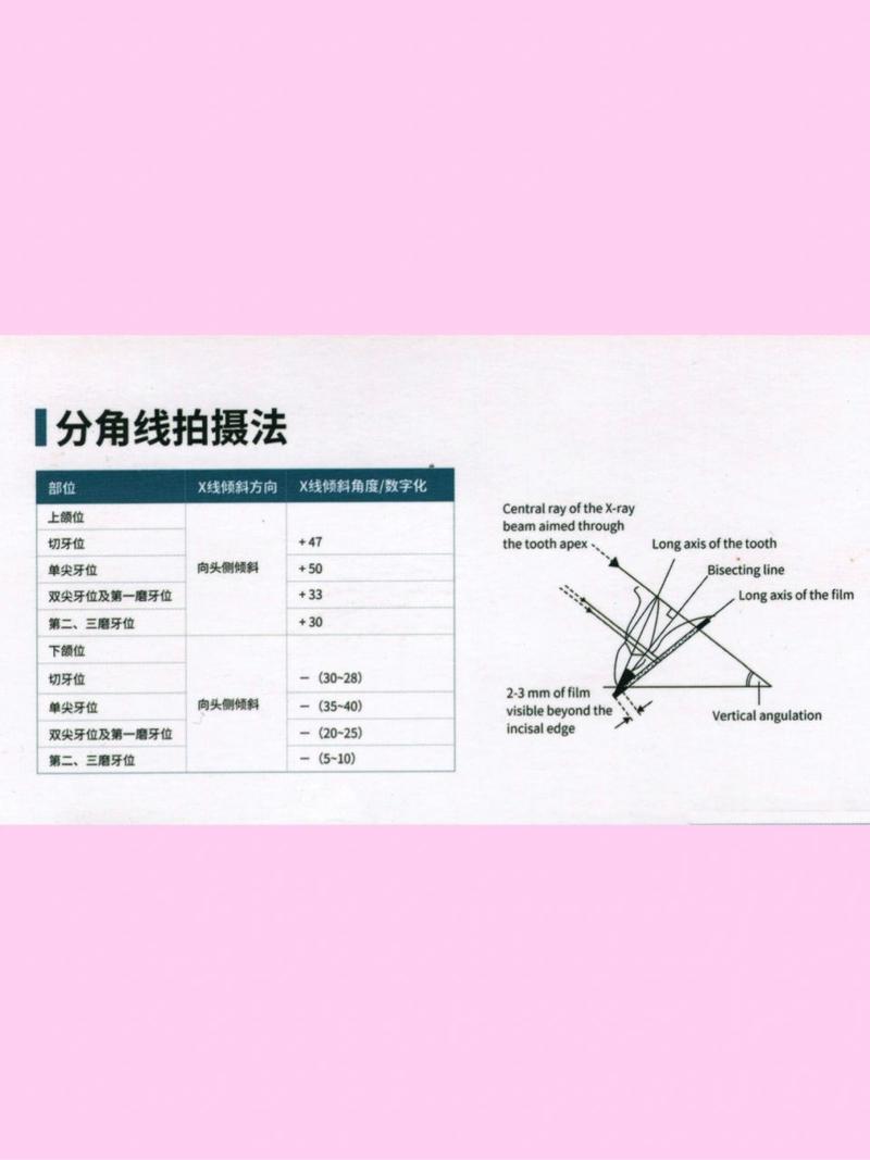 口腔科X线拍摄方法如何选择？不同类型的关键步骤与注意事项？-图1