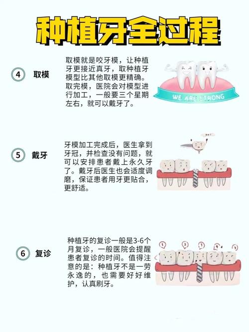 种牙为何要取自身骨?这个过程如何操作?患者需注意什么?-图1 种牙为何要取自身骨?这个过程如何操作?患者需注意什么?-图1