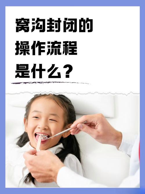 牙沟封闭有几种方法？常见封闭方式有哪些？-图3
