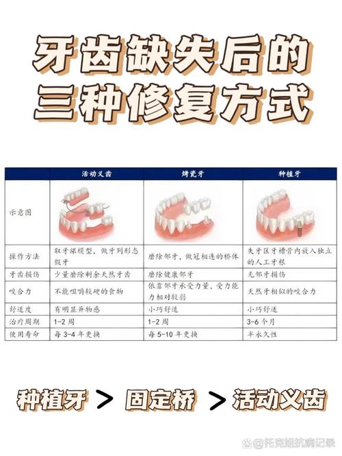 断牙修复方法有几种?各自适合哪种牙齿情况?-图1 断牙修复方法有几种?各自适合哪种牙齿情况?-图1