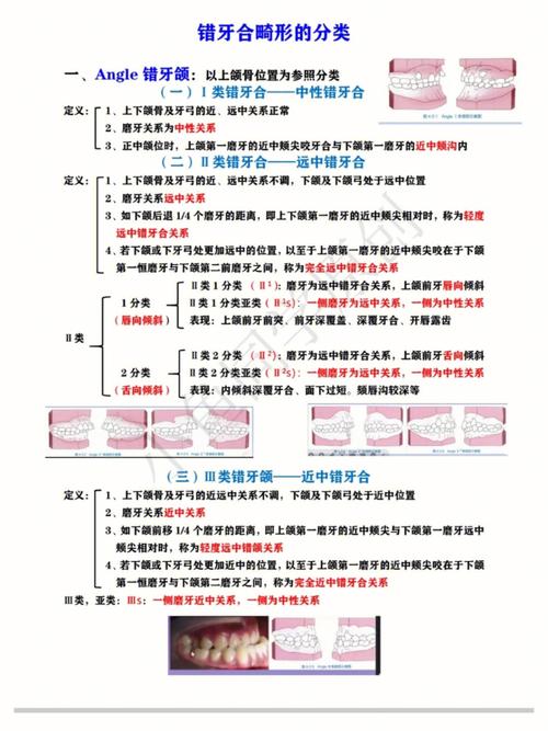 正畸骨性错颌的分类依据和类型有哪些?-图1 正畸骨性错颌的分类依据和类型有哪些?-图1