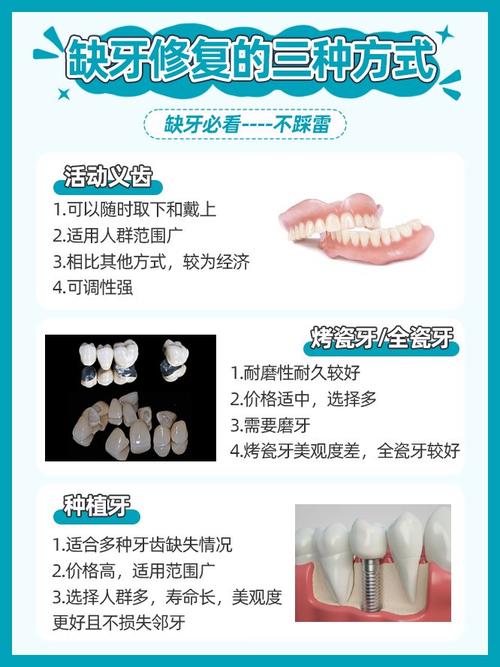 缺牙最快有牙的方法是什么？种植牙真能最快速修复吗？-图1