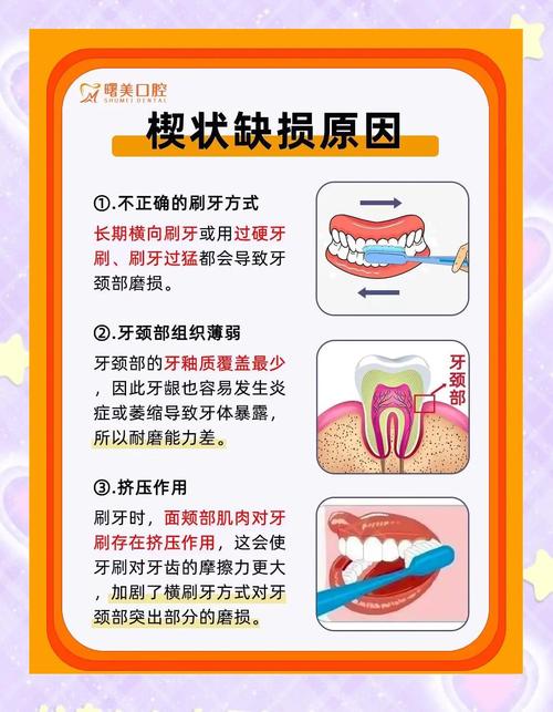 缺牙最快有牙的方法是什么？种植牙真能最快速修复吗？-图2
