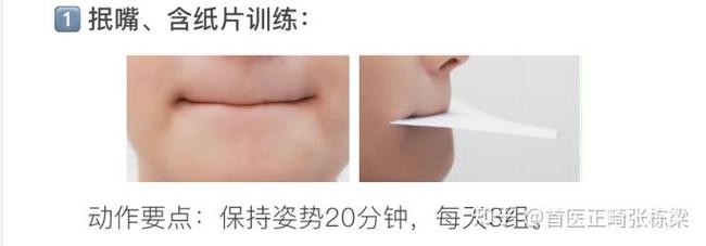 正畸者唇肌训练方法有哪些科学有效的具体步骤?-图1 正畸者唇肌训练方法有哪些科学有效的具体步骤?-图1