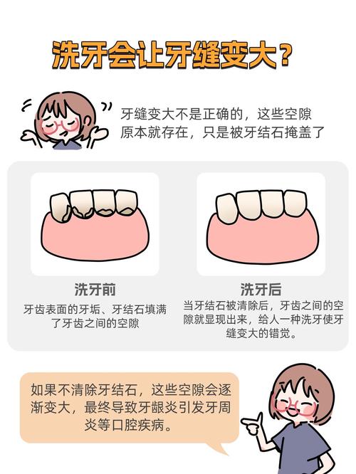 牙缝宽最好处理方法是什么？哪种方式更安全有效？-图2