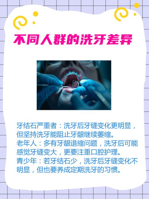 牙缝宽最好处理方法是什么？哪种方式更安全有效？-图1