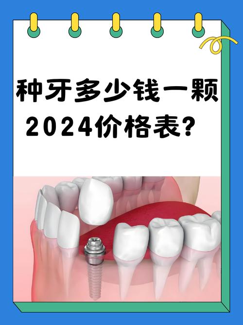 安徽地区种牙多少钱-图1