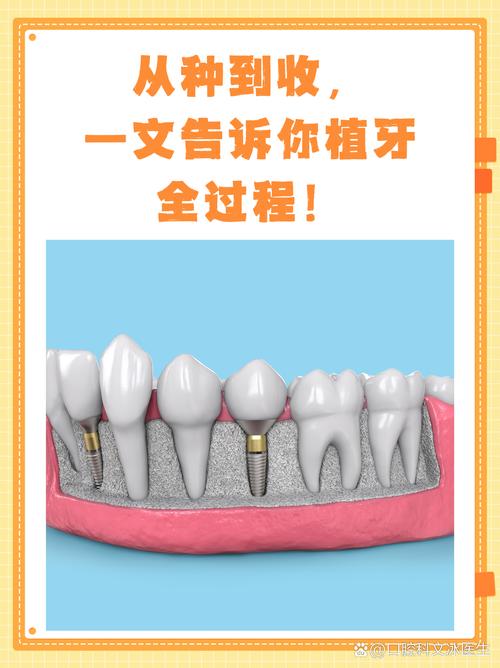 从种牙到结束，整个治疗过程究竟需要多长时间？-图3