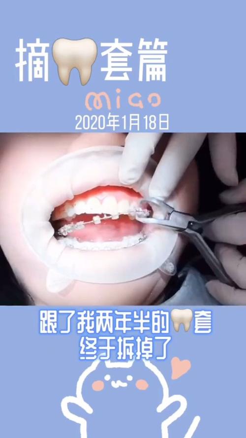 牙齿正畸合同常见违约情形有哪些？-图2