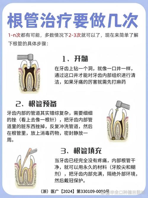种牙还要根管治疗吗-图1
