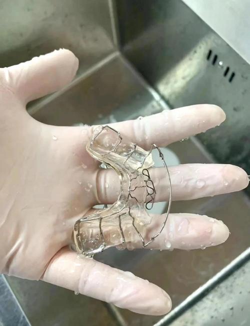 正畸颌垫的制作方法-图1