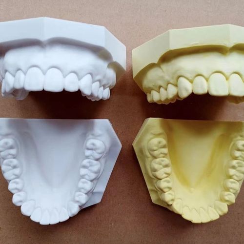 全口缺牙怎么办?有哪些修复方法可选?-图1 全口缺牙怎么办?有哪些修复方法可选?-图1