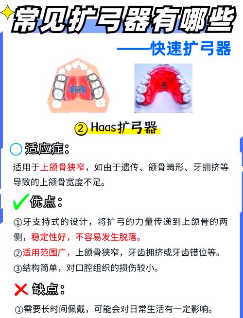 根管扩大仪使用方法-图2