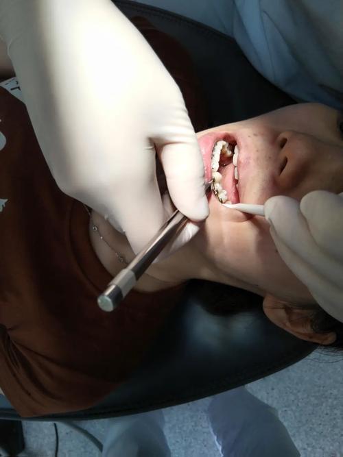 东莞哪里做正畸比较好-图3