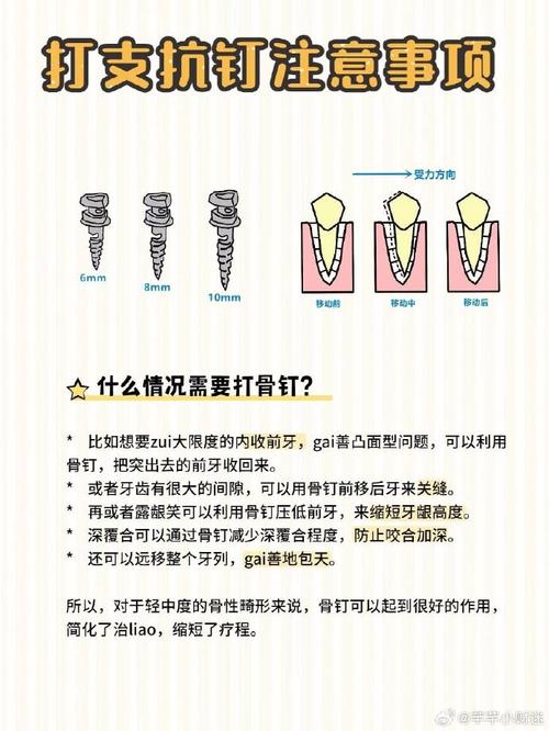 正畸中支抗是什么意思？它在牙齿矫正中起什么作用？-图2