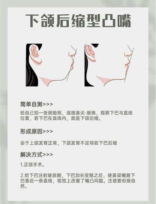 自己能改善反颌吗？有哪些实用方法可行？-图1