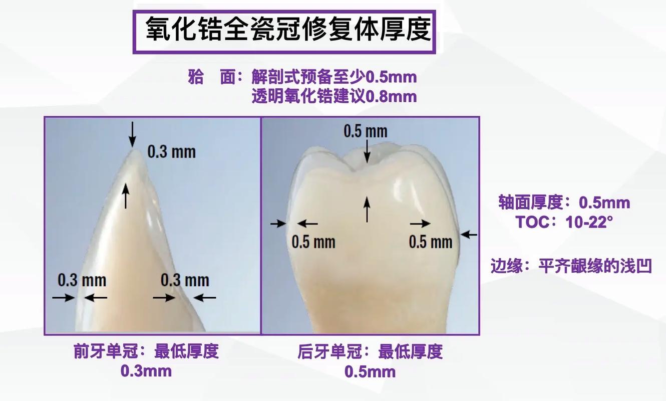 烤瓷牙预备的方法步骤具体有哪些操作要点?-图2 烤瓷牙预备的方法步骤具体有哪些操作要点?-图2