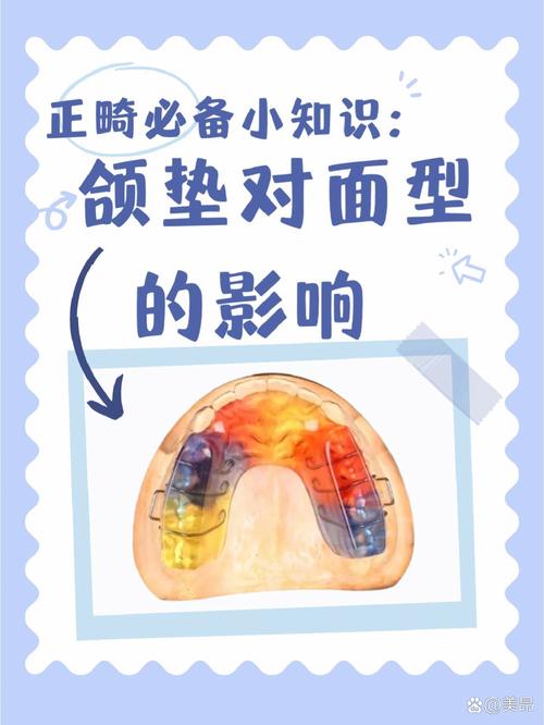 正畸治疗牙颌垫的作用-图2