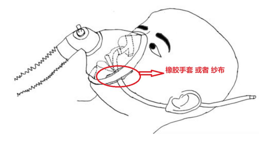 下颌铰链轴固定方法如何选择与操作以保障稳定性？-图1