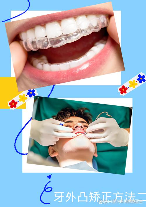 外国人都做牙齿正畸吗-图1