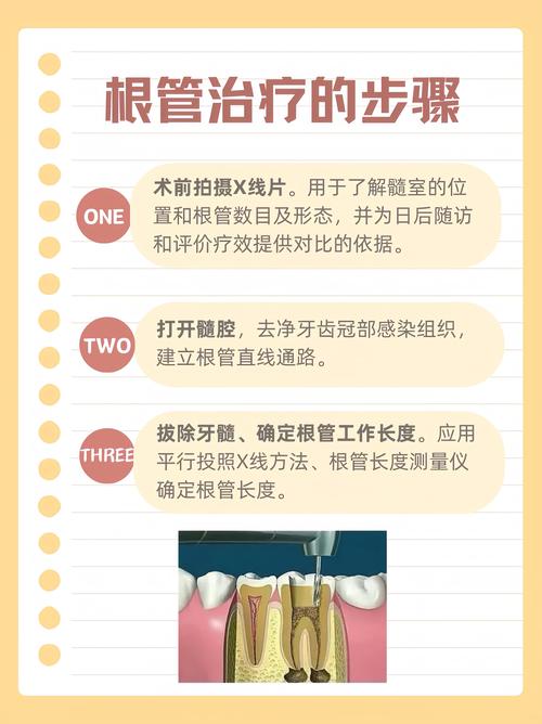 龋齿痛牙医治疗方法-图1