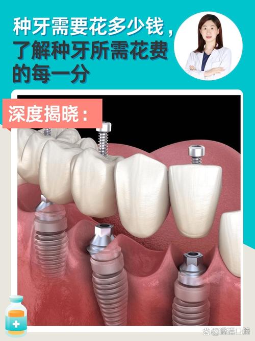 北京种牙医院哪家好？专业机构怎么选？口碑和价格怎么看？-图2