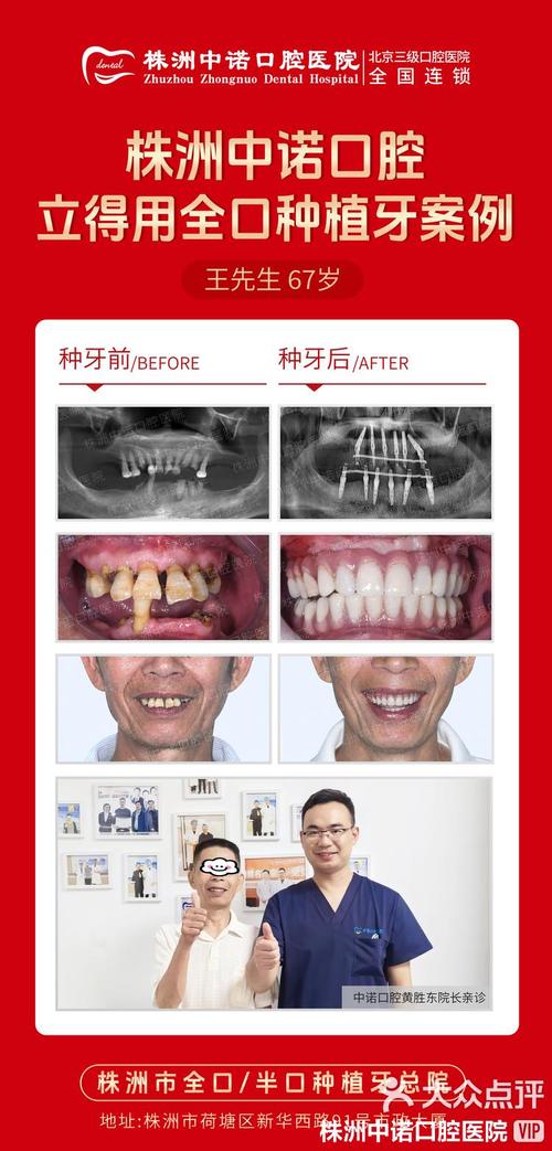 种满口牙能报医疗吗-图2
