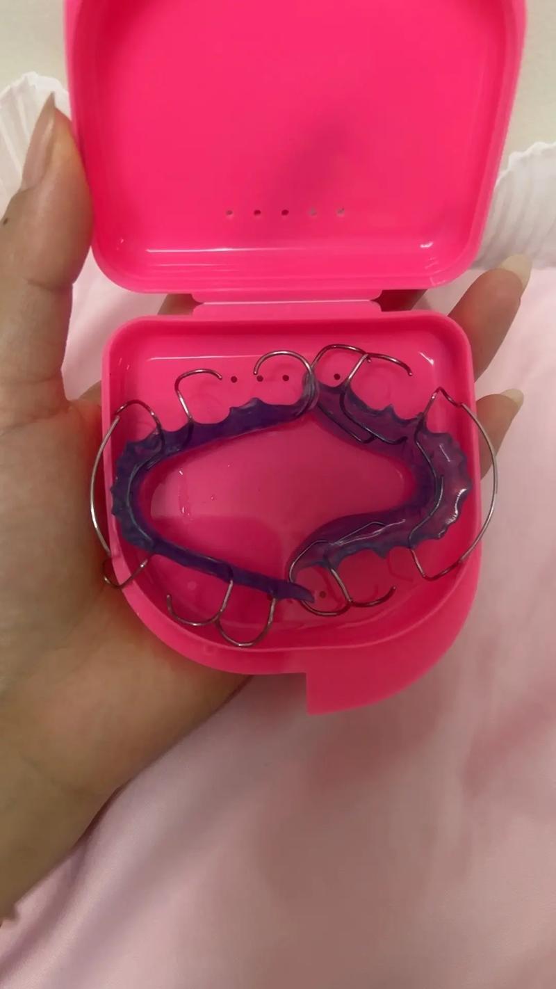 透明保持器要戴方法-图1